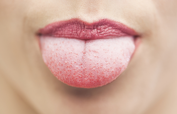 Dilinizin şekli ve rengi sağlığınız hakkında ne söylüyor?